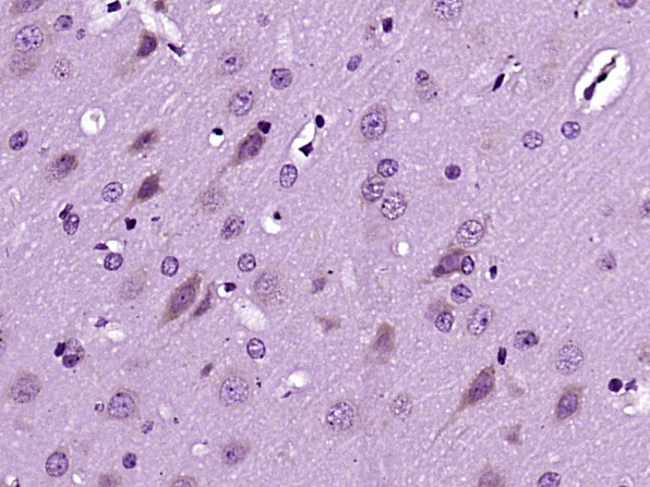 Dscam Antibody in Immunohistochemistry (Paraffin) (IHC (P))