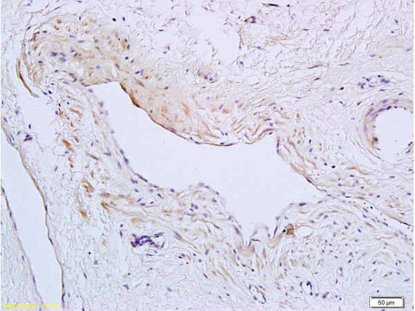 TSLC1 Antibody in Immunohistochemistry (Paraffin) (IHC (P))