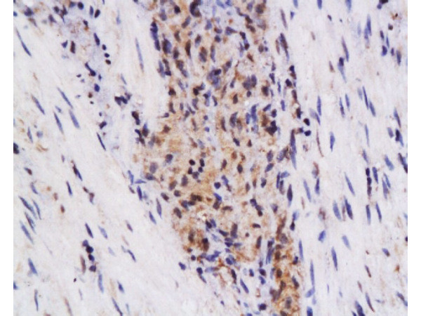 TSLC1 Antibody in Immunohistochemistry (Paraffin) (IHC (P))