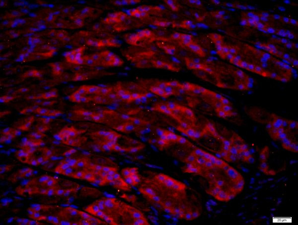 UNC5B/UNC5H2 Antibody in Immunohistochemistry (Paraffin) (IHC (P))