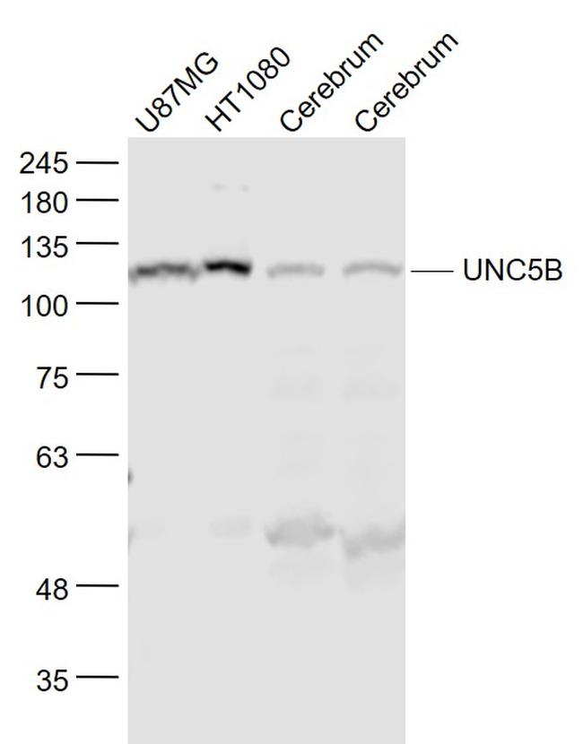 UNC5B/UNC5H2 Antibody in Western Blot (WB)