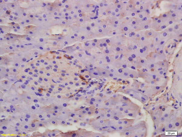 EDA Antibody in Immunohistochemistry (Paraffin) (IHC (P))