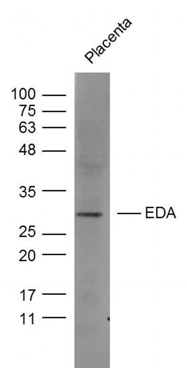 EDA Antibody in Western Blot (WB)