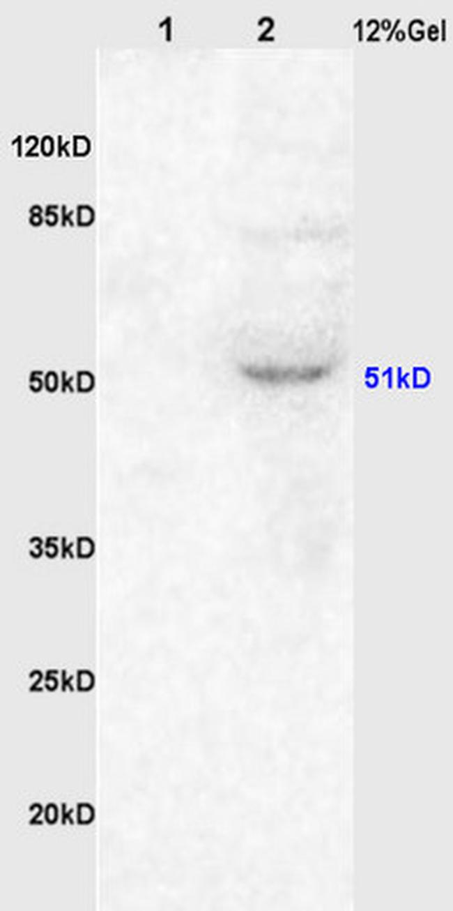 muscarinic Acetylcholine Receptor 1 Antibody in Western Blot (WB)