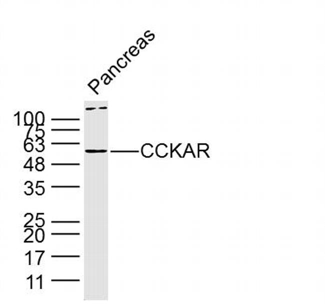 CCKAR Antibody in Western Blot (WB)