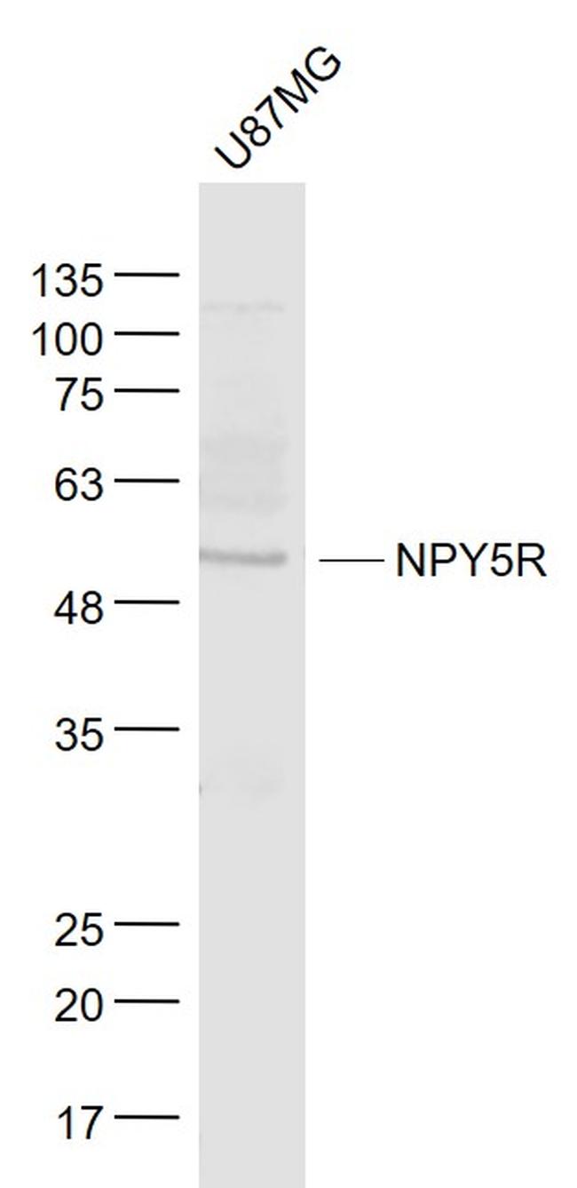 NPY5R Antibody in Western Blot (WB)