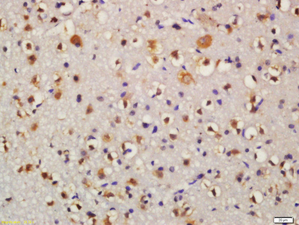 Bid Antibody in Immunohistochemistry (Paraffin) (IHC (P))