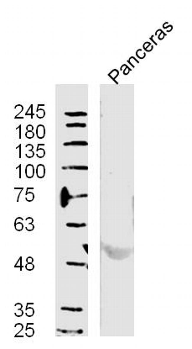 Phospho-ERK5 (Thr219, Tyr221) Antibody in Western Blot (WB)