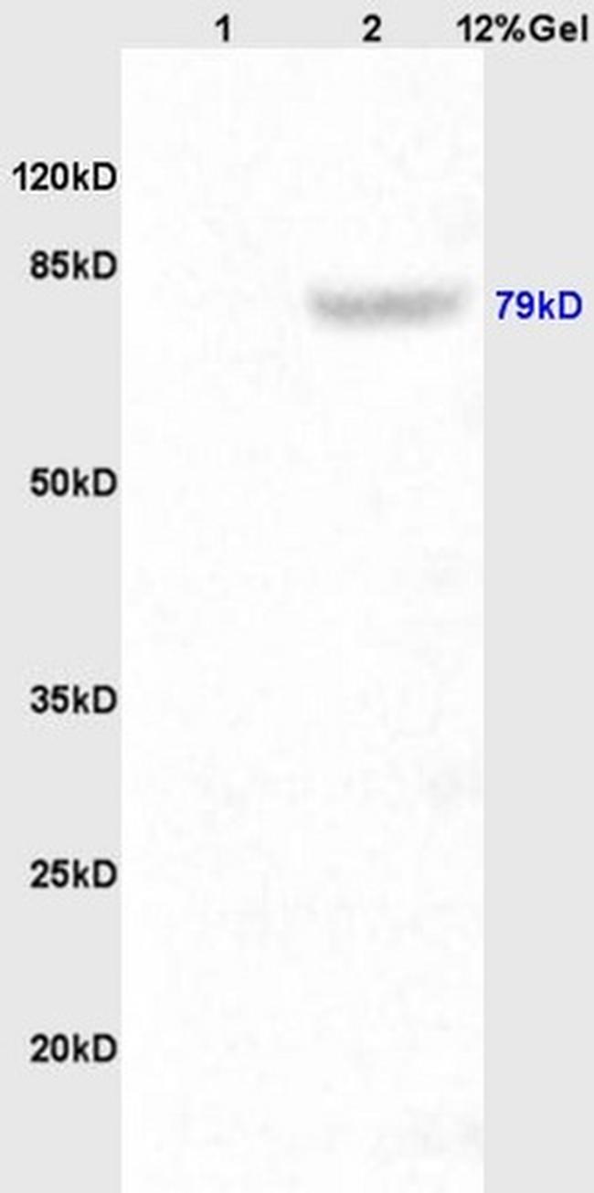 P-cadherin Antibody in Western Blot (WB)