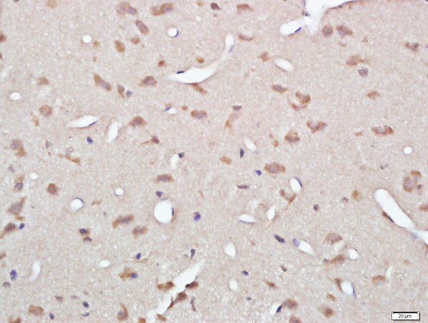 Gelsolin Antibody in Immunohistochemistry (Paraffin) (IHC (P))