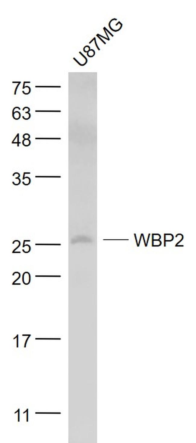 WBP2 Antibody in Western Blot (WB)