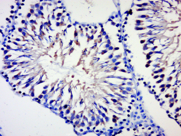 BPTF/FALZ Antibody in Immunohistochemistry (Paraffin) (IHC (P))