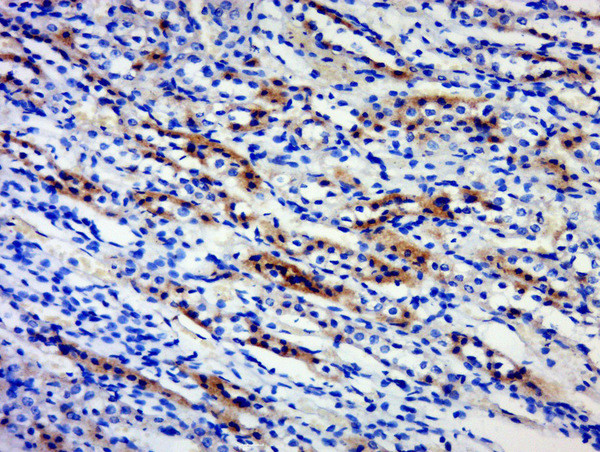 BPTF/FALZ Antibody in Immunohistochemistry (Paraffin) (IHC (P))