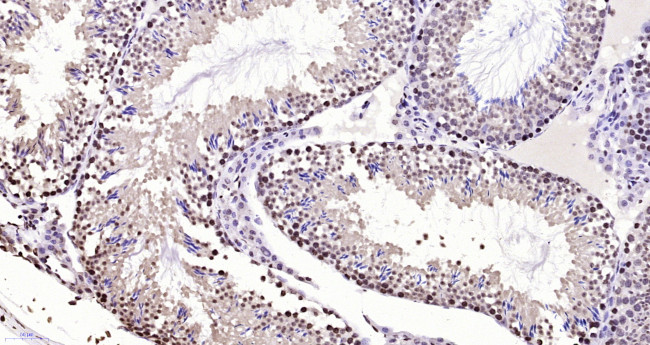 BPTF/FALZ Antibody in Immunohistochemistry (Paraffin) (IHC (P))