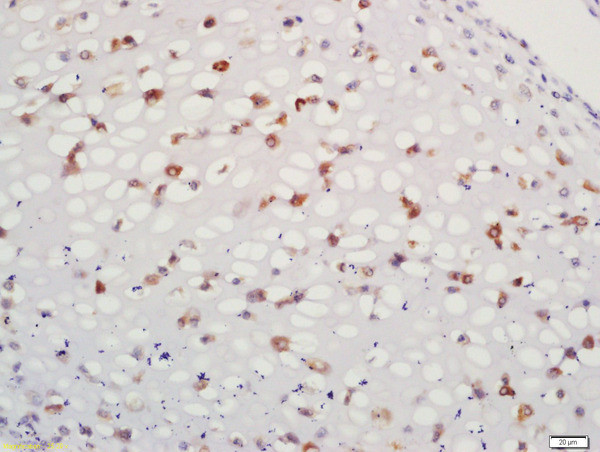 Aggrecan Antibody in Immunohistochemistry (Paraffin) (IHC (P))