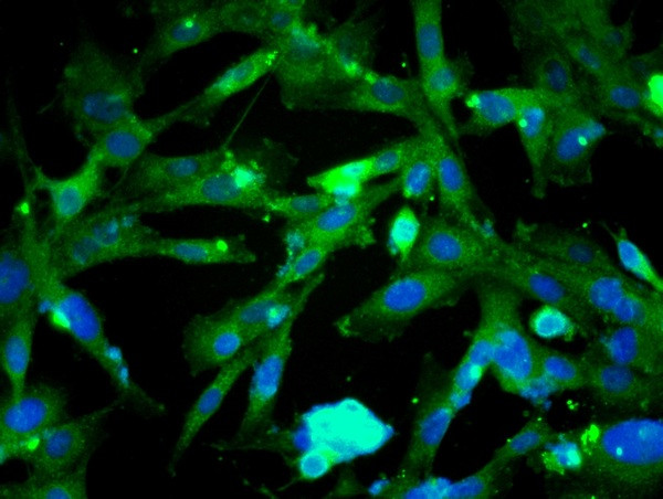 Beta catenin Antibody in Immunocytochemistry (ICC/IF)