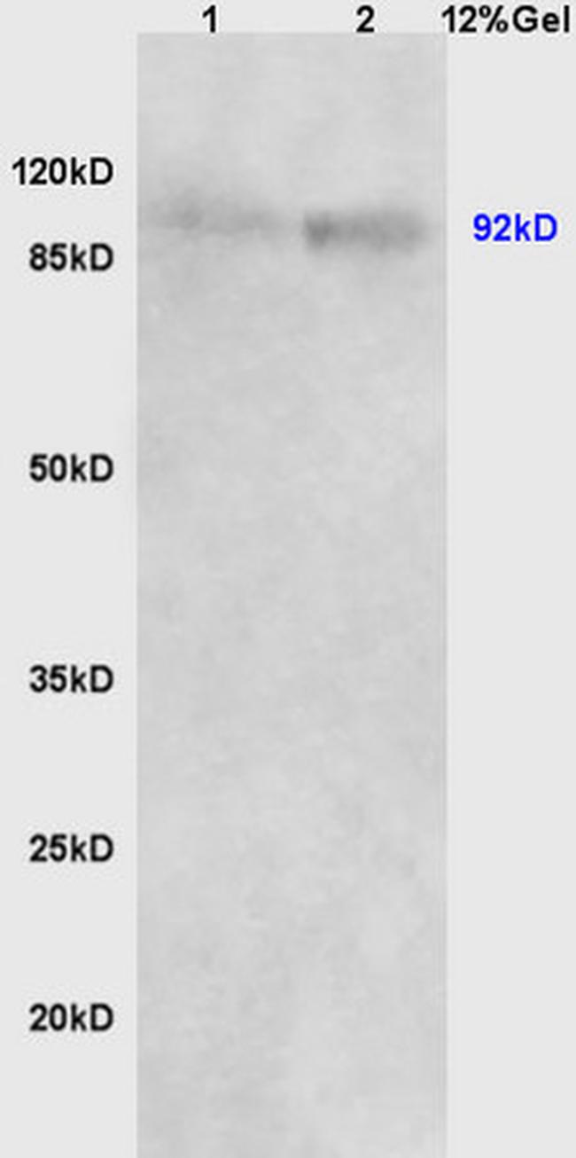 Beta catenin Antibody in Western Blot (WB)