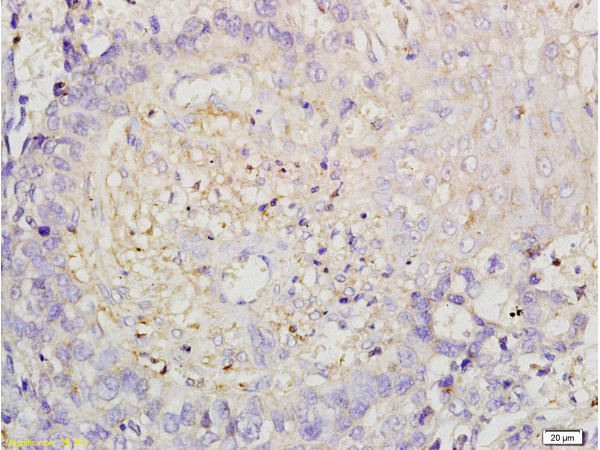 ROCK1 Antibody in Immunohistochemistry (Paraffin) (IHC (P))