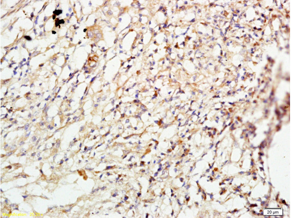 ROCK1 Antibody in Immunohistochemistry (Paraffin) (IHC (P))