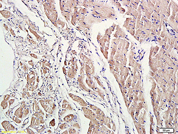 ROCK1 Antibody in Immunohistochemistry (Paraffin) (IHC (P))