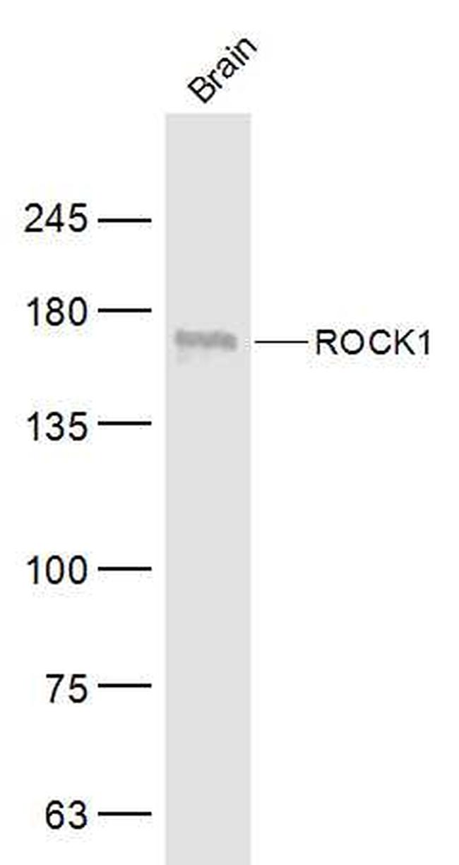 ROCK1 Antibody in Western Blot (WB)