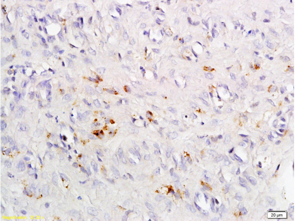 CCR4 Antibody in Immunohistochemistry (Paraffin) (IHC (P))