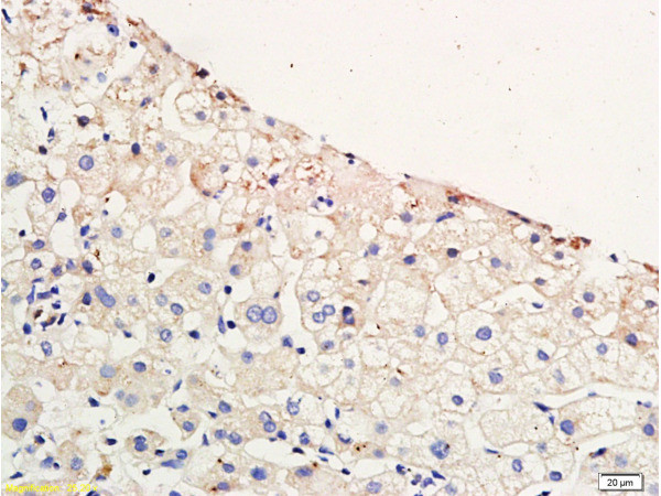 CCR4 Antibody in Immunohistochemistry (Paraffin) (IHC (P))