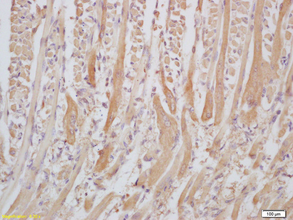 Senataxin/SETX Antibody in Immunohistochemistry (Paraffin) (IHC (P))