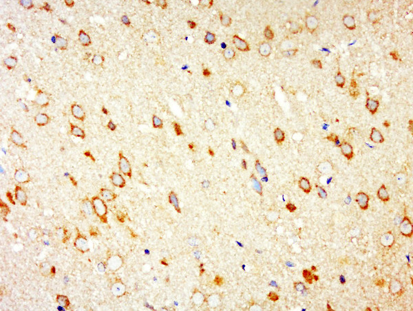 PARK9/ATP13A2 Antibody in Immunohistochemistry (Paraffin) (IHC (P))