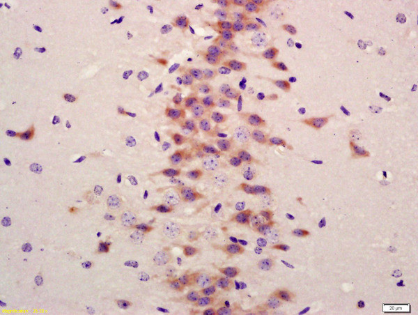 LC3A/B Antibody in Immunohistochemistry (Paraffin) (IHC (P))