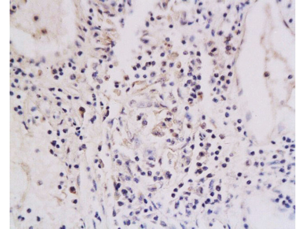 TNFRSF18 Antibody in Immunohistochemistry (Paraffin) (IHC (P))