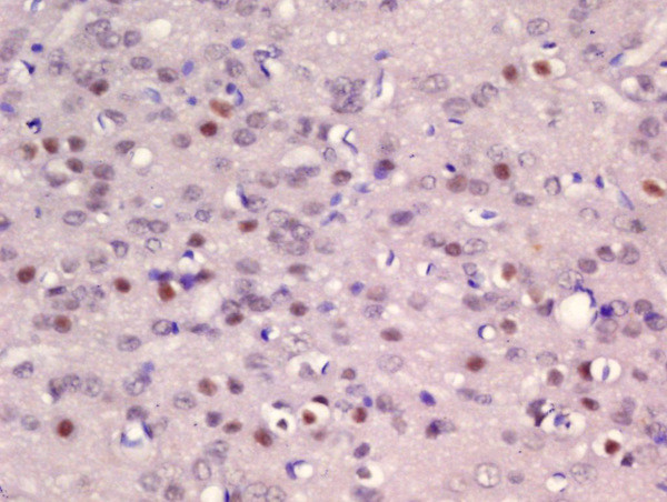 ER81 Antibody in Immunohistochemistry (Paraffin) (IHC (P))