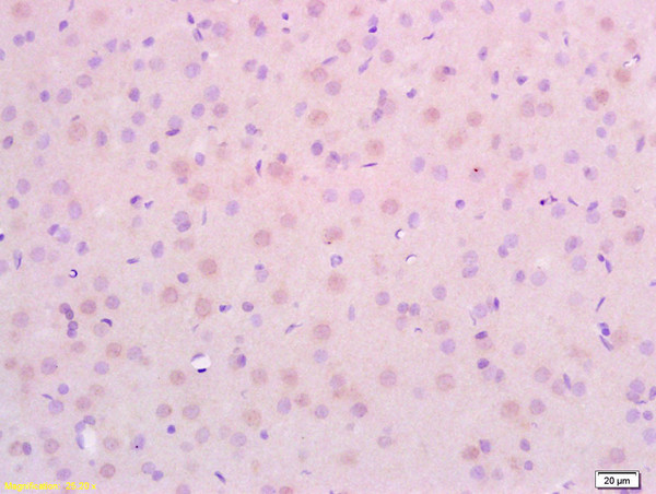 CDKN2A/p19ARF Antibody in Immunohistochemistry (Paraffin) (IHC (P))