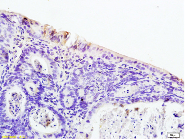 PAR-2 Antibody in Immunohistochemistry (Paraffin) (IHC (P))