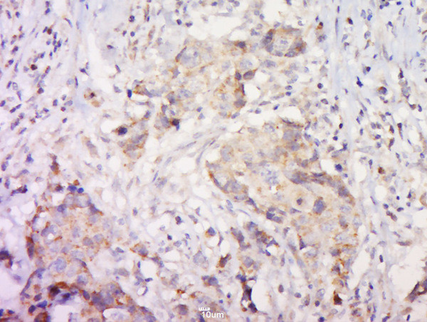 PAR-2 Antibody in Immunohistochemistry (Paraffin) (IHC (P))