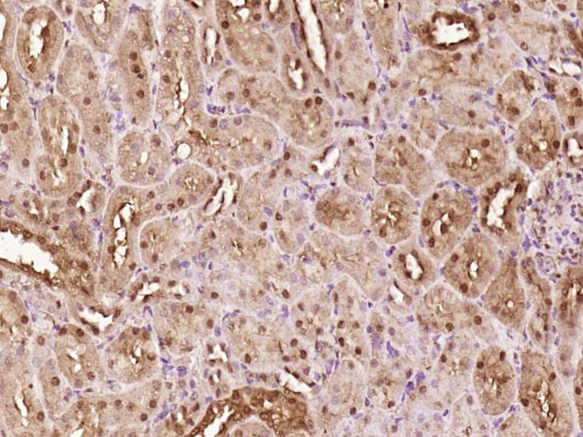 ATBF1 Antibody in Immunohistochemistry (Paraffin) (IHC (P))