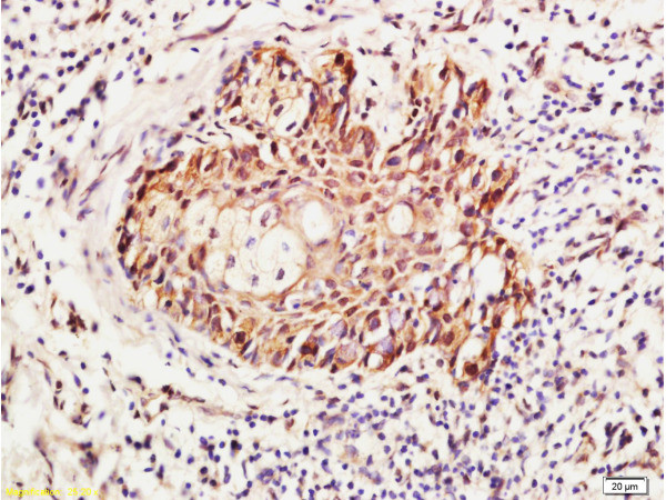 RhoA/C Antibody in Immunohistochemistry (Paraffin) (IHC (P))