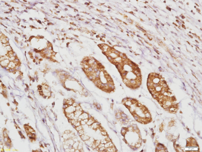 RhoA/C Antibody in Immunohistochemistry (Paraffin) (IHC (P))