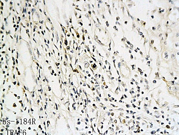 TRAF6 Antibody in Immunohistochemistry (Paraffin) (IHC (P))