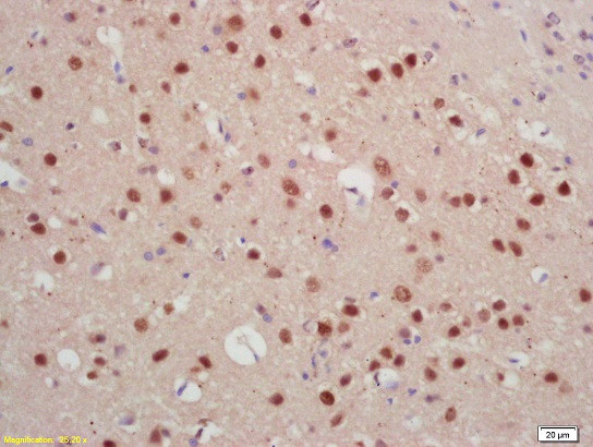 Jarid2/Jumonji Antibody in Immunohistochemistry (Paraffin) (IHC (P))