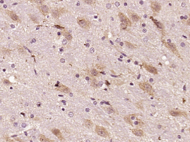 Shootin/KIAA1598 Antibody in Immunohistochemistry (Paraffin) (IHC (P))