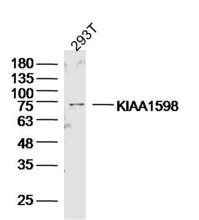 Shootin/KIAA1598 Antibody in Western Blot (WB)