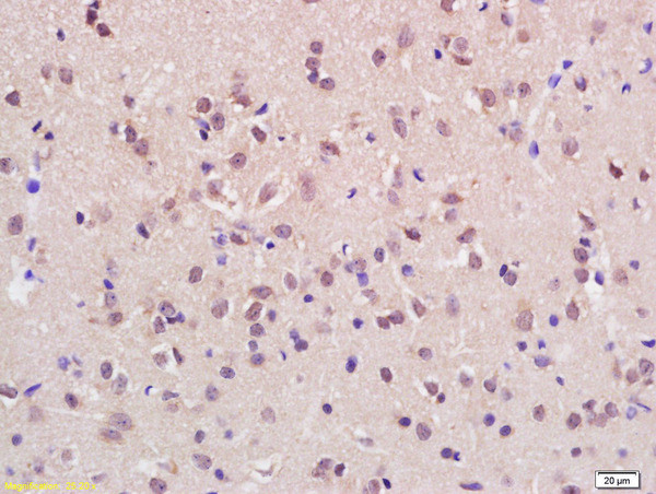 KMT2H/ASH1L Antibody in Immunohistochemistry (Paraffin) (IHC (P))