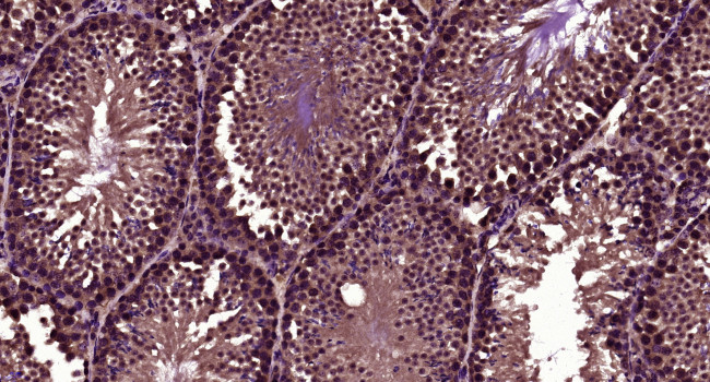 LBX1 Antibody in Immunohistochemistry (Paraffin) (IHC (P))