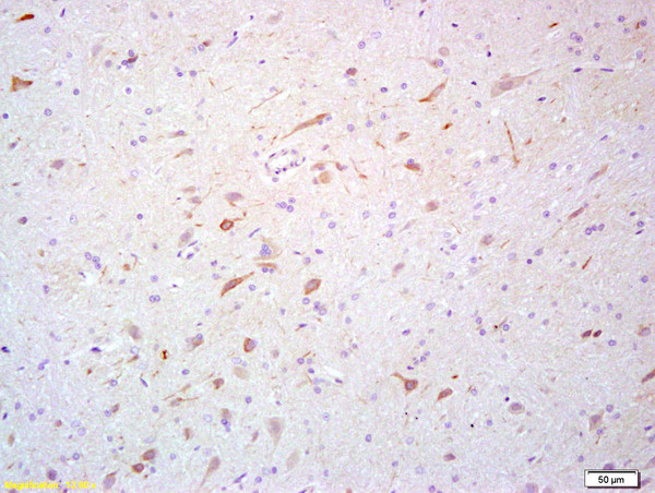 Scavenger receptor class B member 1 Antibody in Immunohistochemistry (Paraffin) (IHC (P))