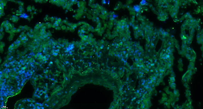 NAV2/RAINB1 Antibody in Immunohistochemistry (Paraffin) (IHC (P))