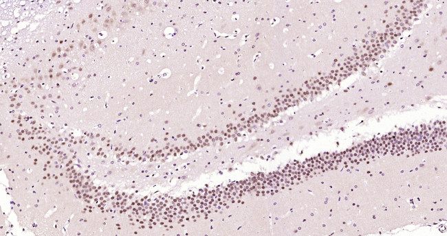 NFIA/NF-1 Antibody in Immunohistochemistry (Paraffin) (IHC (P))