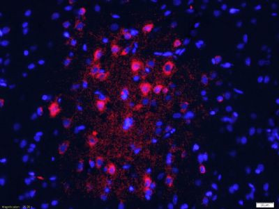 NRG1 Antibody in Immunohistochemistry (Paraffin) (IHC (P))