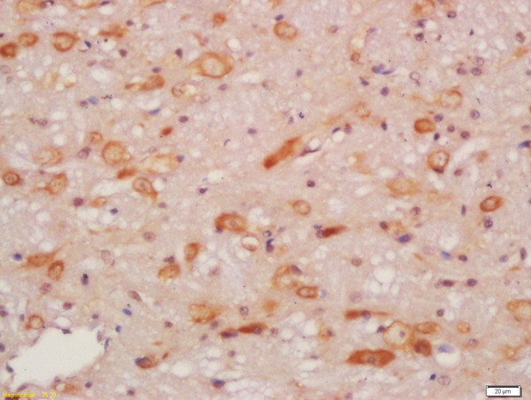 NRG1 Antibody in Immunohistochemistry (Paraffin) (IHC (P))