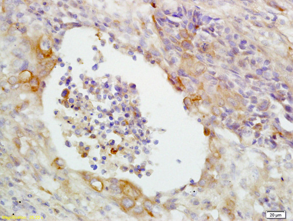 CD14 Antibody in Immunohistochemistry (Paraffin) (IHC (P))